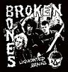 Broken Bones - Sticker